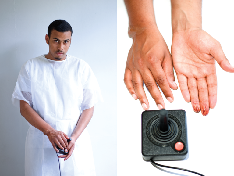 讓你手指變成奇形怪狀的電玩傷害