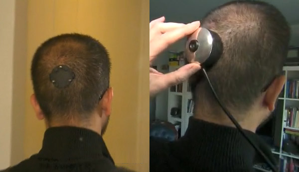 眼睛長在頭上？對！紐約大學教授在後腦杓裝上攝影機