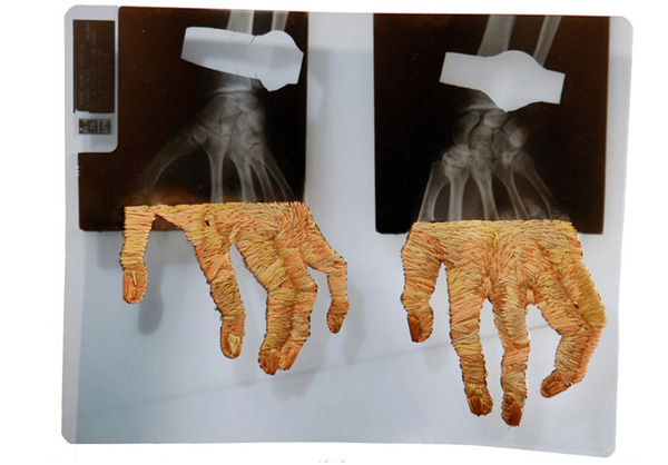 看了有點毛骨悚然的刺繡X光