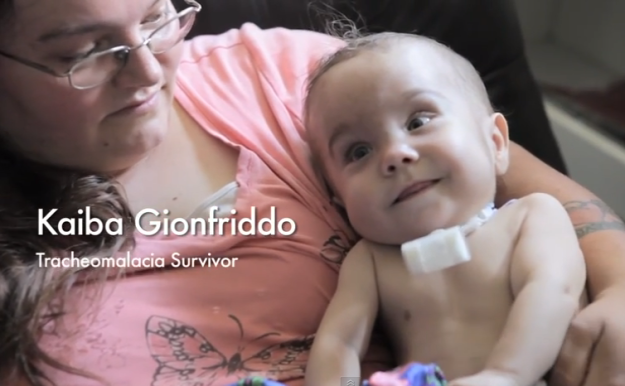 3D列印如何救人一命