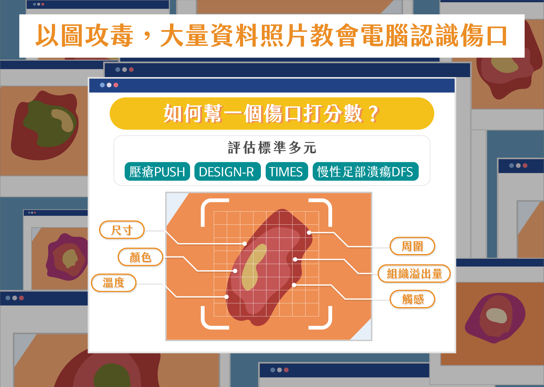 偏鄉醫療的神兵利器，iSCare 慢性傷口智慧照護系統分擔醫護壓力