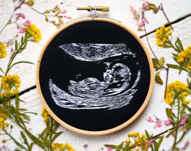 繡出生命感動一刻！藝術家Yulia Sherbak記錄生命美好的超音波刺繡