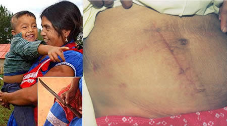 10件比巧合還神奇的生命奇蹟