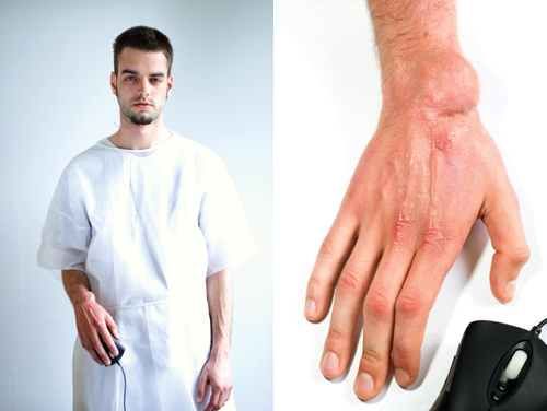 讓你手指變成奇形怪狀的電玩傷害