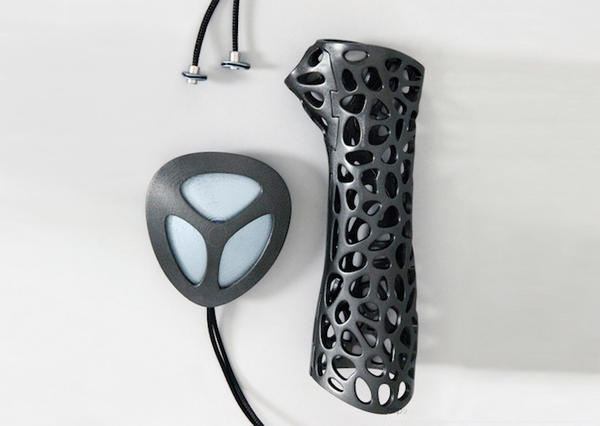 3D列印石膏進化版 讓傷口好更快